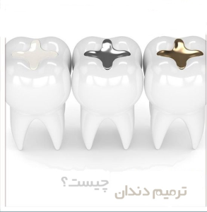 ترمیم دندان